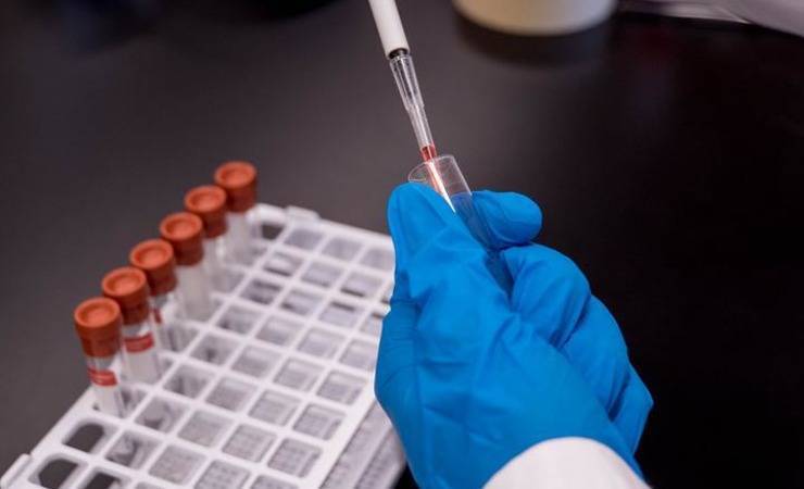 В Беларуси начали испытывать российскую вакцину от коронавируса на неделю раньше запланированного