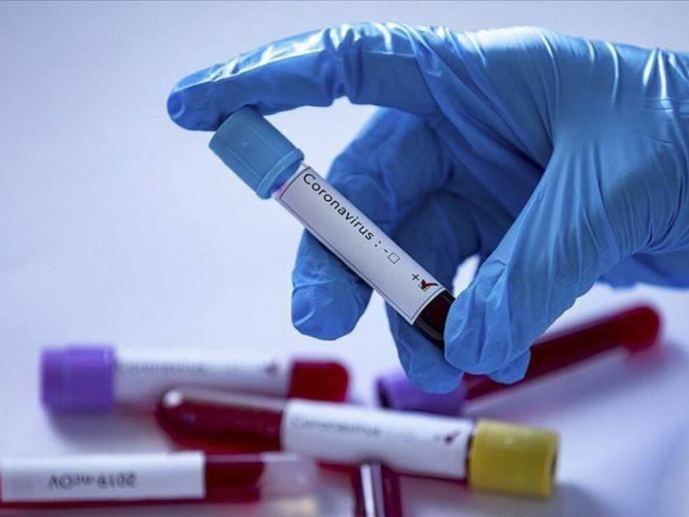 За сутки в Украине выявили еще 2723 случая заражения коронавирусом