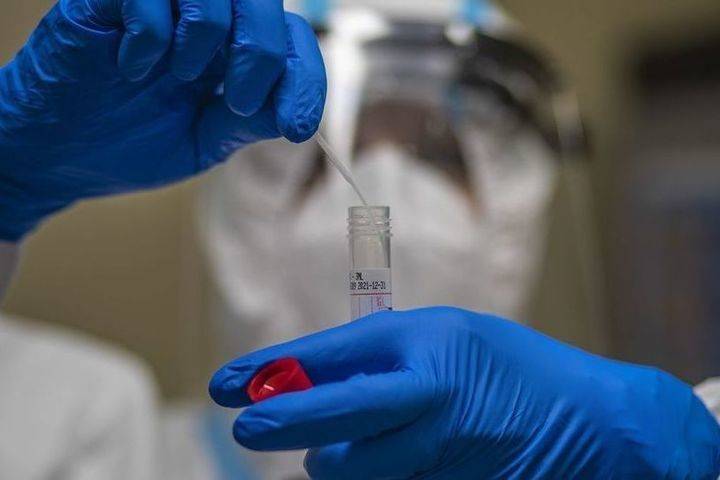 В Чувашии за сутки от коронавируса умерли 13 человек