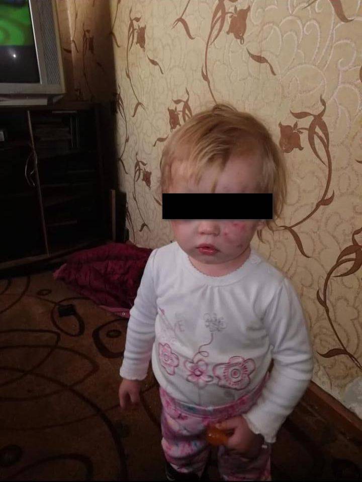 Прокуратура начала проверку из-за детей, доставленных с гематомами в Рязанскую ОКБ
