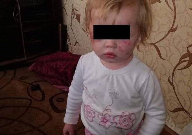 После избиения малышей в Рыбном на их мать завели уголовное дело