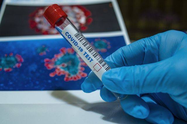 Исследователи обнаружили «‎память» человеческого организма на коронавирусы