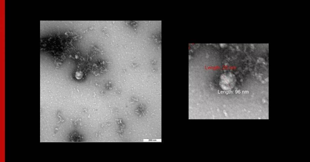 Первое фото "британского" штамма коронавируса сделали в "Векторе"
