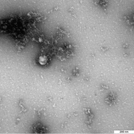 Ученые из "Вектора" показали "фотографию" британского штамма SARS-CoV-2