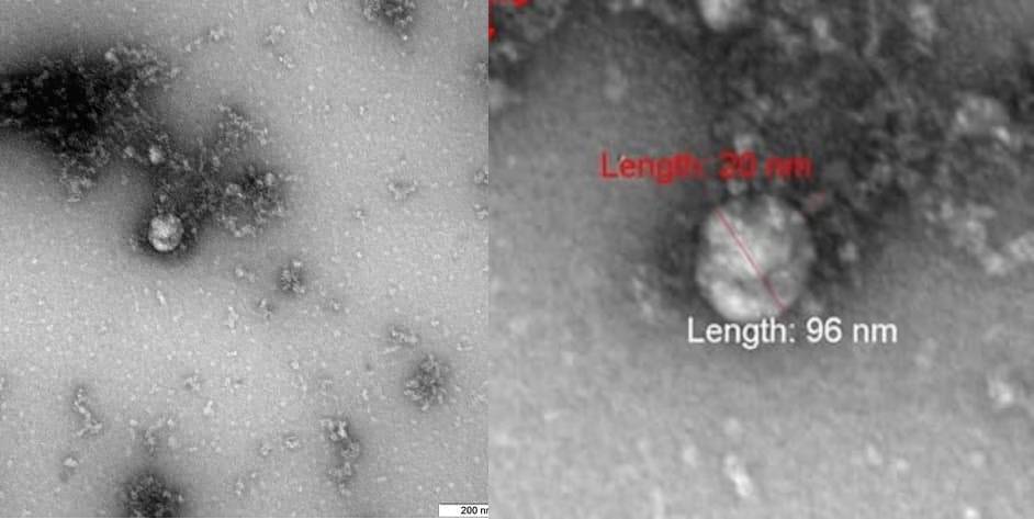 Ученые «Вектора» показали фото «британского» штамма коронавируса
