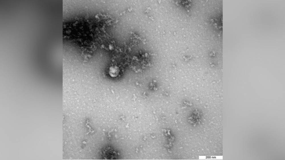 Российские ученые сделали первое фото "британского" штамма коронавируса