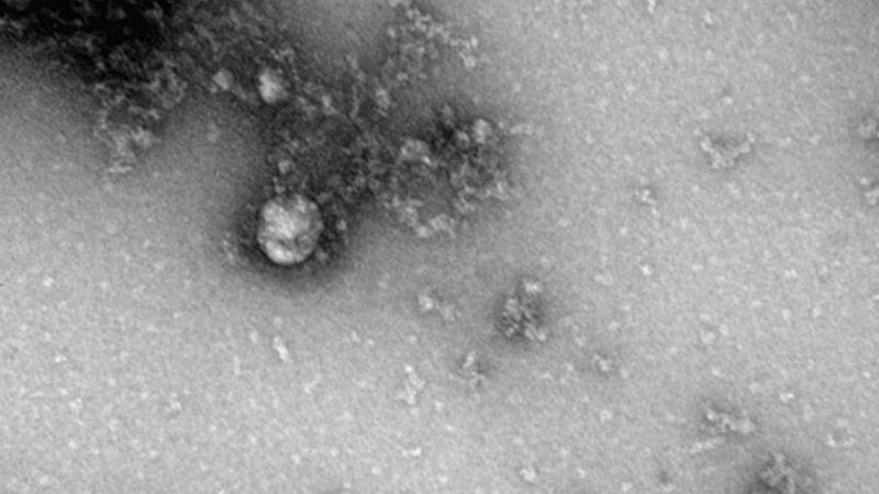 Российские ученые первыми в мире сфотографировали британский штамм коронавируса