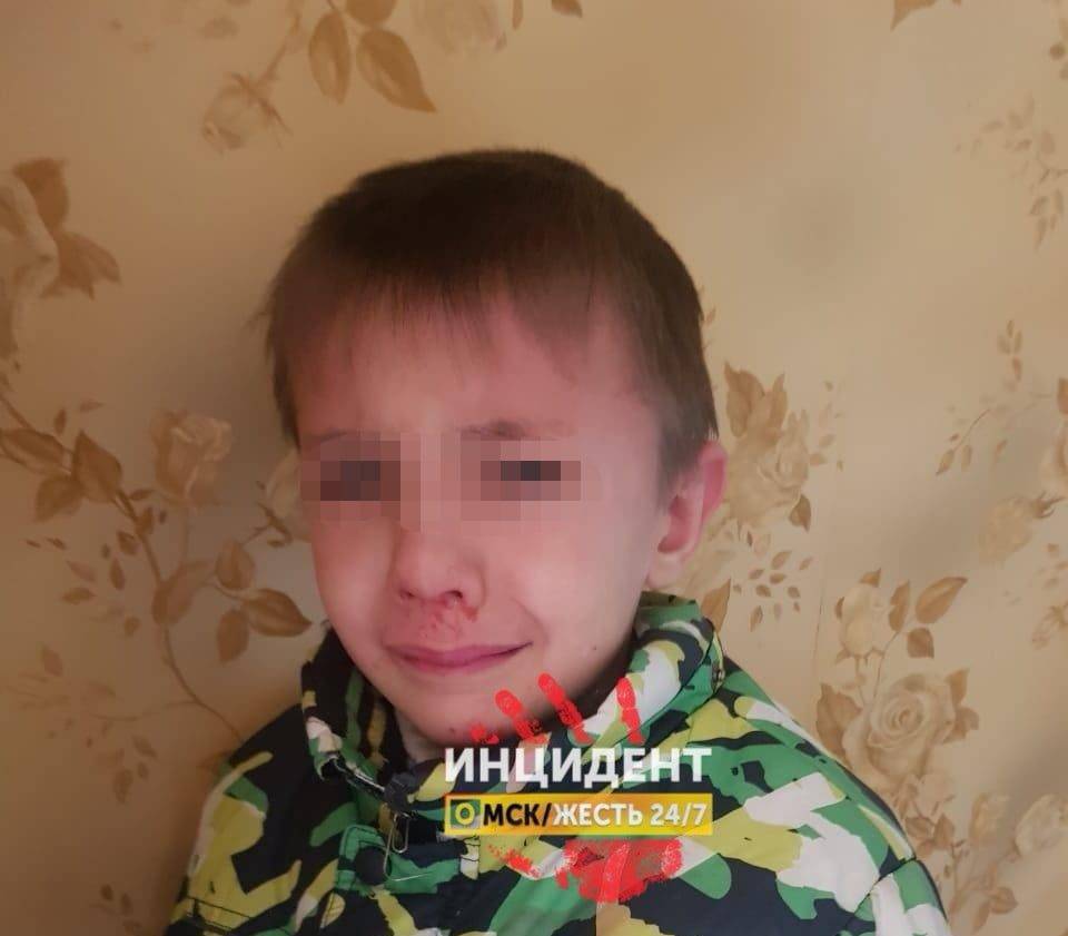 В Омске задержали мужчину, который избил своих детей