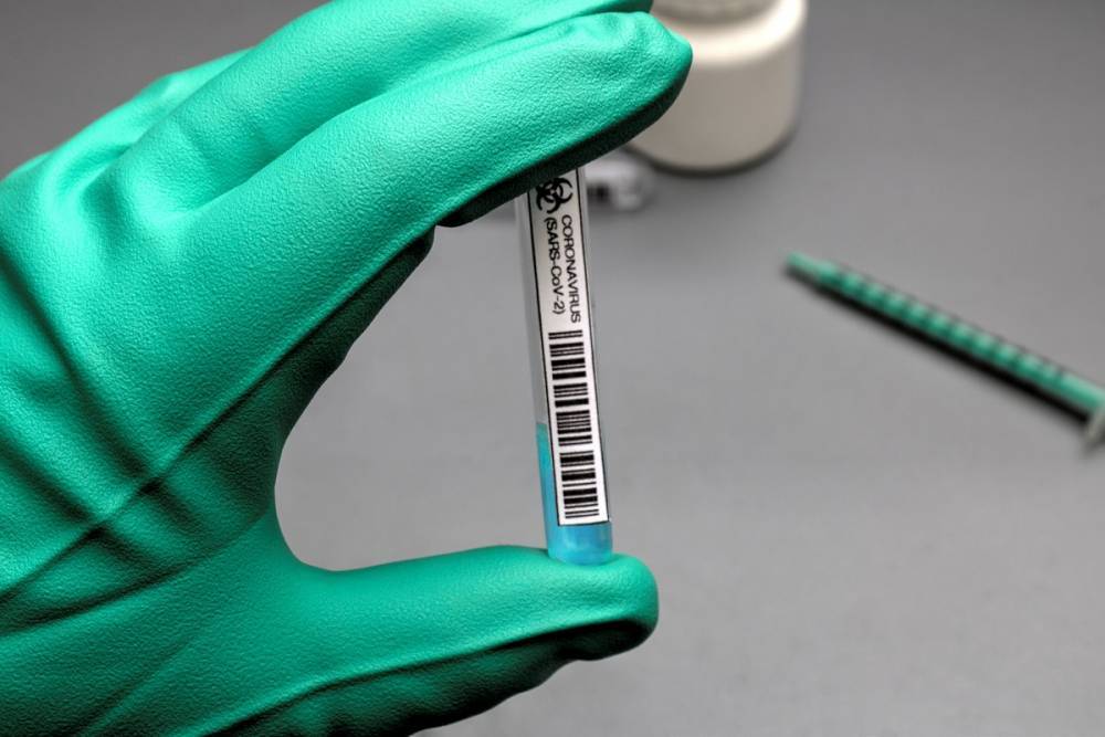 За сутки тест на коронавирус сдали около 23 тыс. петербуржцев