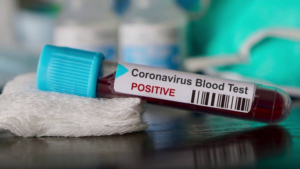 18-й случай смерти от коронавируса зарегистрирован на Сахалине