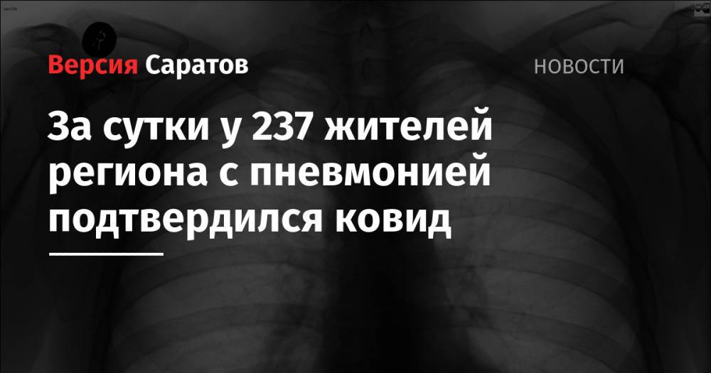 За сутки у 237 жителей региона с пневмонией подтвердился ковид