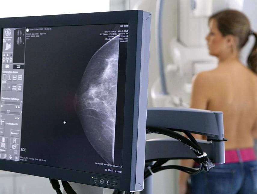 Рак молочной железы не приговор: онкологи — о новых методах лечения коварной болезни