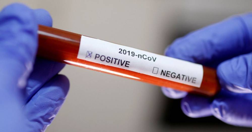 В Украине зафиксировано более 15,5 новых случаев заражения коронавирусом