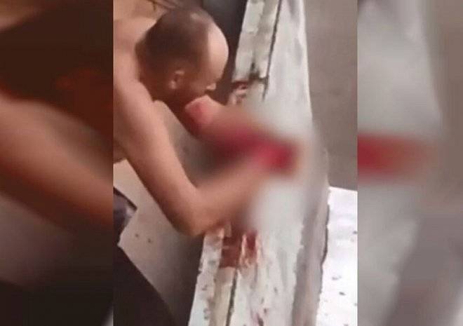 В Приморье пьяный мужчина отрезал себе руку и выбросил ее с балкона