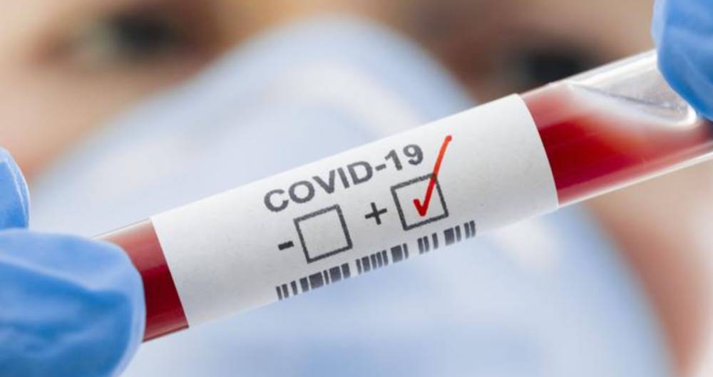 В Украине за сутки зафиксировано 18 912 новых случаев инфицирования COVID-19