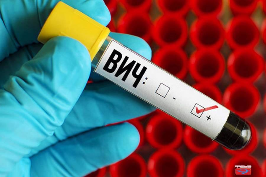За девять месяцев 2021 года в Беларуси зарегистрировано 1.123 новых случая ВИЧ-инфекции