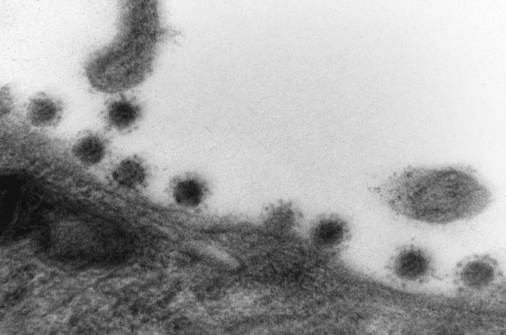 Опубликованы первые фото дельта-штамма коронавируса