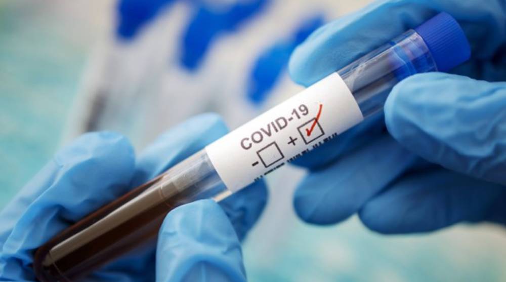 В Украине за сутки зафиксировано 26 198 новых случаев инфицирования COVID-19