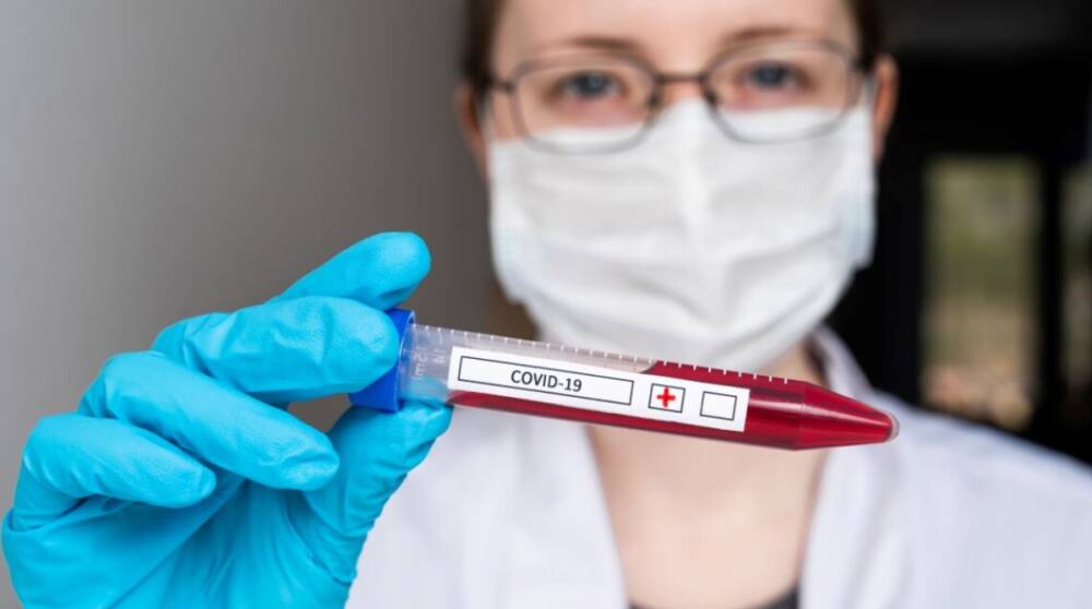За сутки зафиксировали 7 464 новых случаев коронавируса