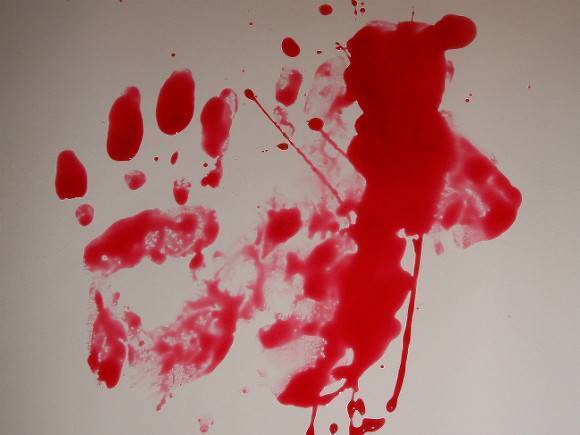 Житель Марий Эл насмерть забил кулаками десятимесячного младенца