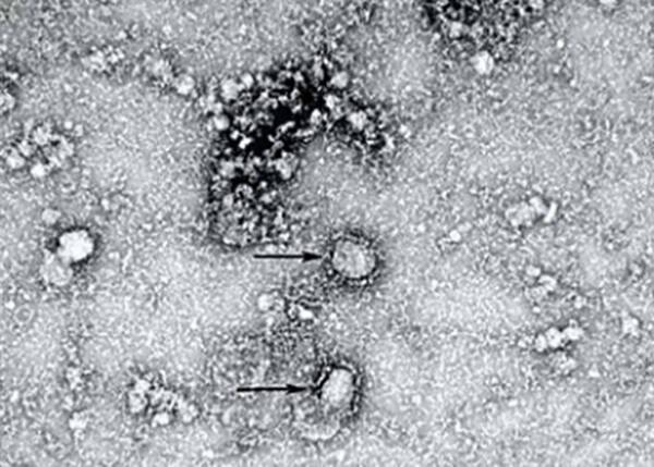Зимняя Универсиада в Люцерне отменена из-за нового штамма коронавируса