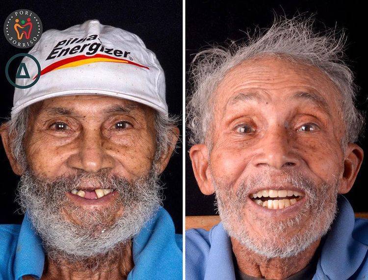 Дантист бесплатно помогает с зубами бедным людям, даже хочется улыбнуться вместе с ними