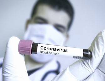 В Ростовской области стало на 650 заболевших коронавирусом больше