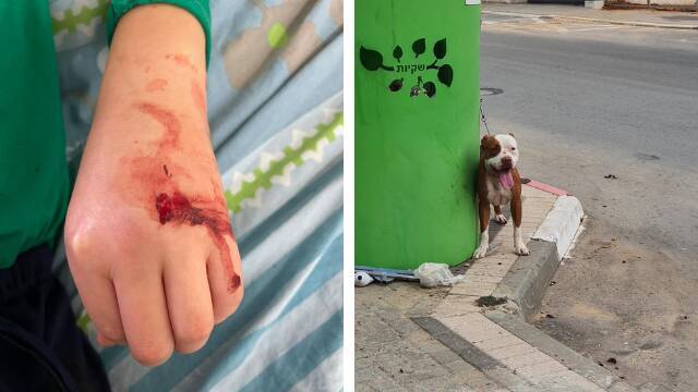 10-летний мальчик в Реховоте защитил собак от чужого амстаффа собственным телом - и пострадал