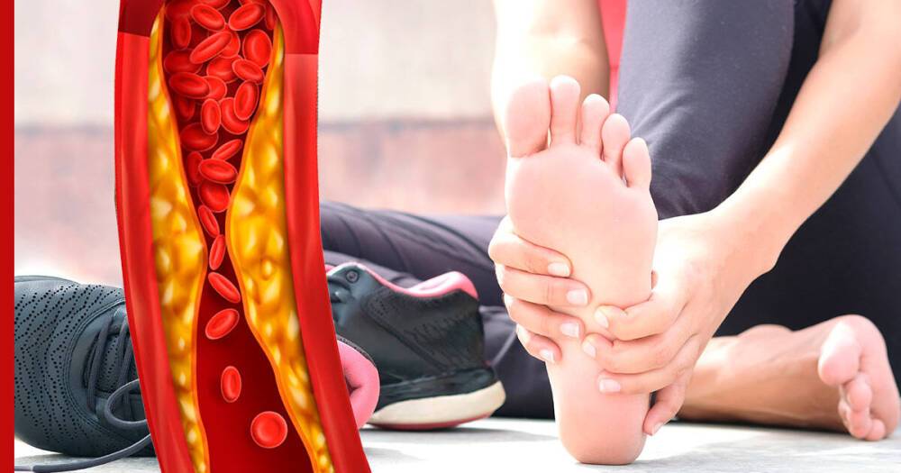 Высокий холестерин: необычные признаки в ногах укажут на опасное состояние