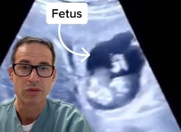 В Канаде беременная женщина вынашивала эмбриона в печени