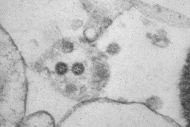 Как выглядят клетки, заражённые «омикроном»: фото учёных
