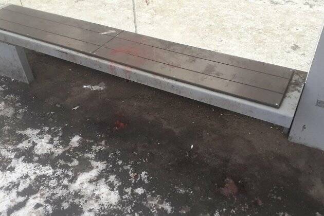 Директор ДМРСУ о крови на скамейке в Чите: Не отмыли — она с первого раза не оттирается