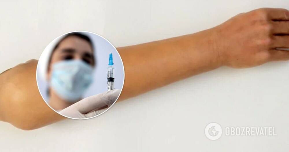 Вакцинация от коронавируса – в Италии мужчина пытался получить прививку от COVID-19 в силиконовую руку, фото