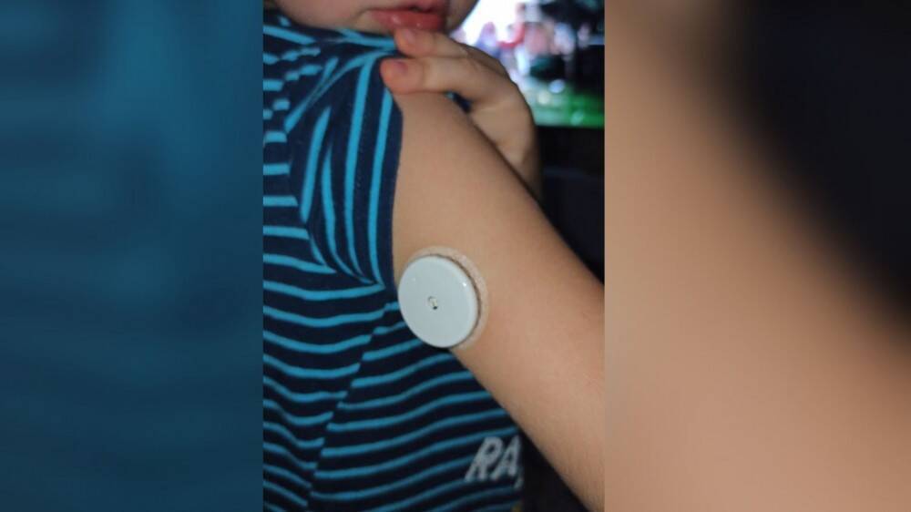Получат ли дети-диабетики Липецка бесплатные системы мониторинга глюкозы?