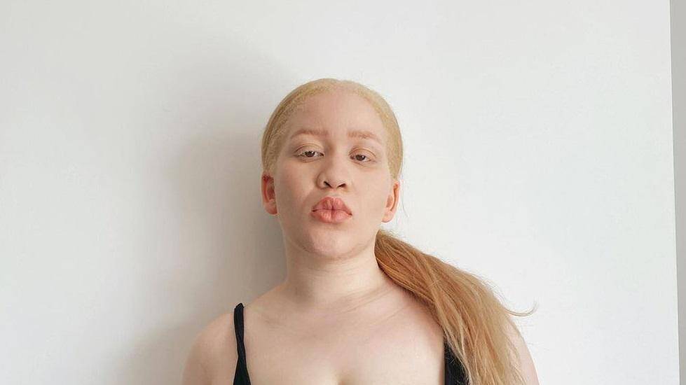 Афробританка родилась альбиноской — теперь она популярная модель plus size