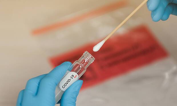 В России срок действий ПЦР-тестов на коронавирус сократили до 48 часов из-за штамма «омикрон»
