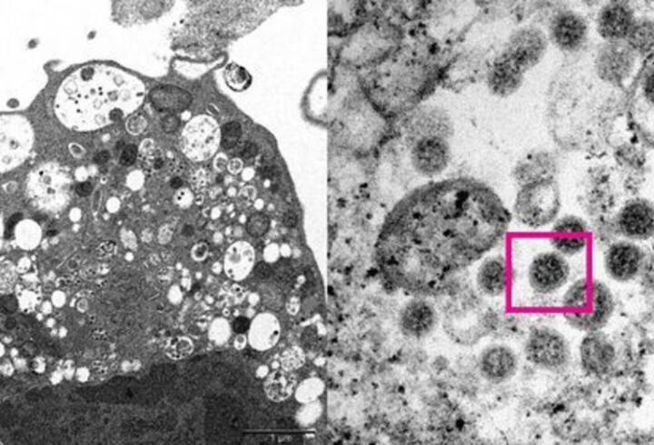 Ученые из Гонконга опубликовали первую фотографию омикрон-штамма коронавируса