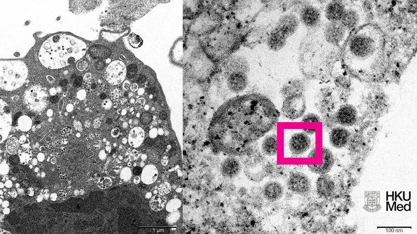 Учёные из Гонконга опубликовали микрофотографию омикрон-штамма