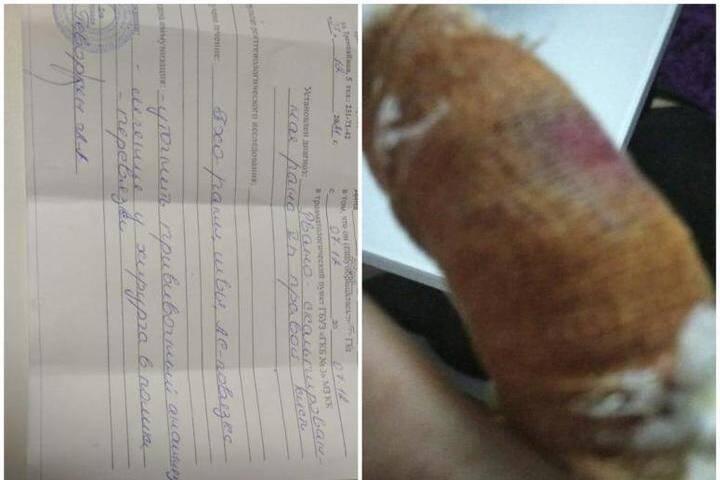 Пожилой жительнице Краснодара оторвало часть пальца в автобусе