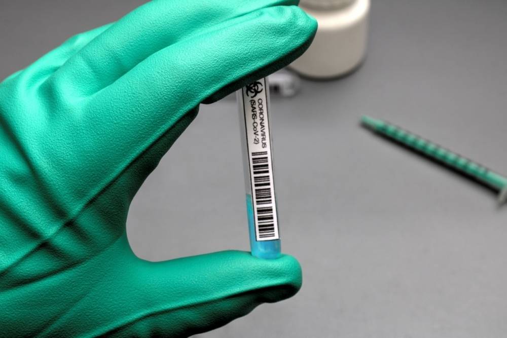 Высокоточный экспресс-тест для выявления вируса SARS-CoV-2 разработали в Роспотребнадзоре