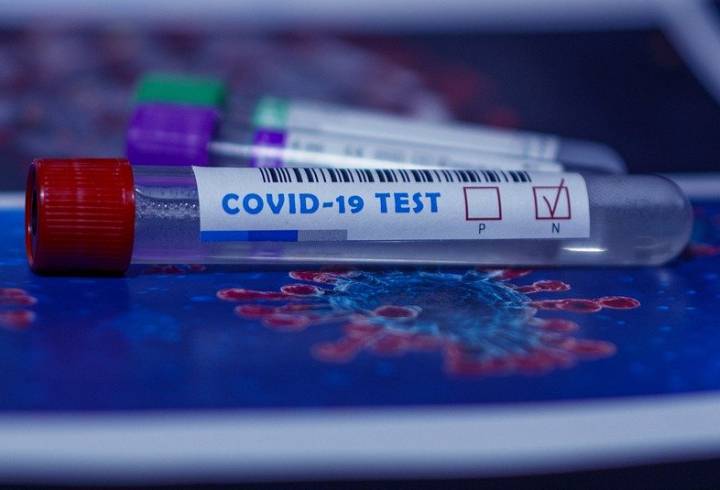Российские учёные разработали метод экспресс-анализа на коронавирусы для людей и животных