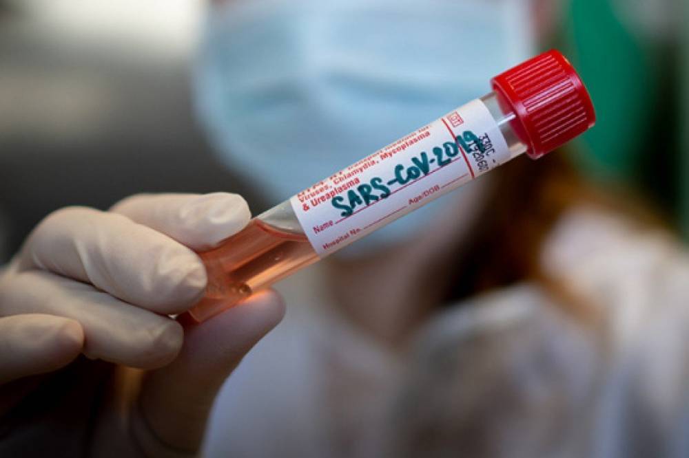 В Украине за минувшие сутки выявили 2394 новых случая коронавируса, выздоровело - 11 457 пациентов