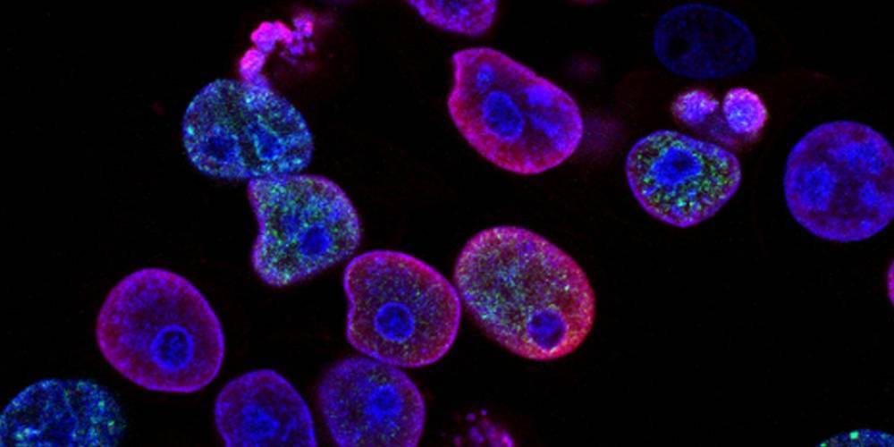 Израильские ученые обнаружили «ахиллесову пяту» раковых клеток