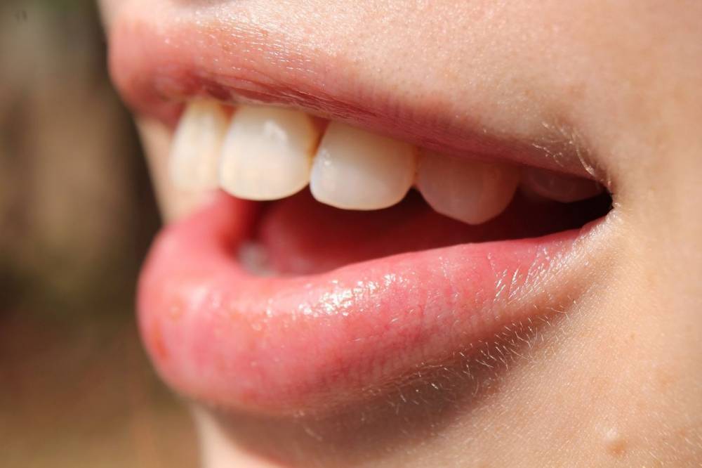 Российский диетолог рассказала о способных отбелить зубы продуктах