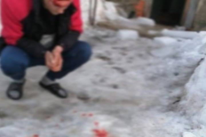 СК начал проверку по факту падения глыбы льда на мужчину в Рязани