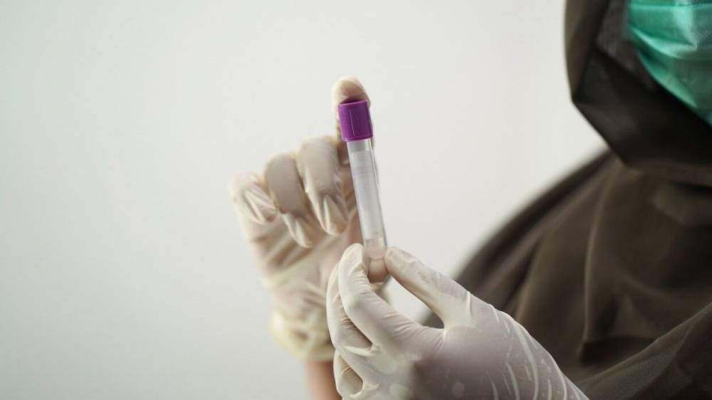 "Эталонный" штамм коронавируса создали в РФ для улучшения тест-систем