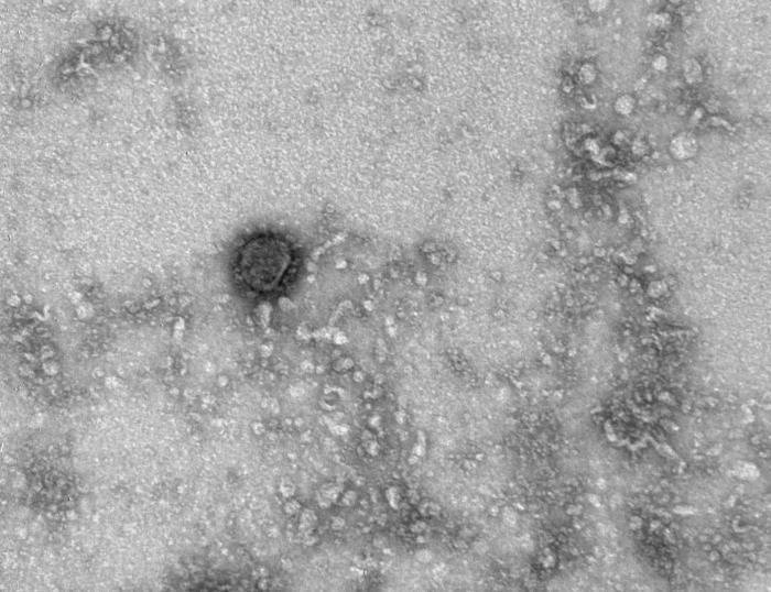 Мутаций коронавируса в Волгоградской области не выявлено