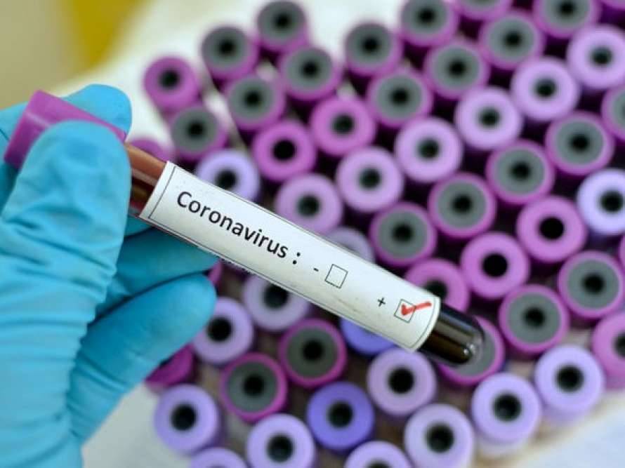 В Украине ожидают пик заболеваемости коронавирусом в течение ближайших недель