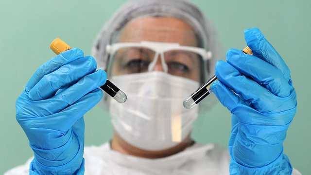 Ученые обнаружили возможную связь коронавируса с группой крови
