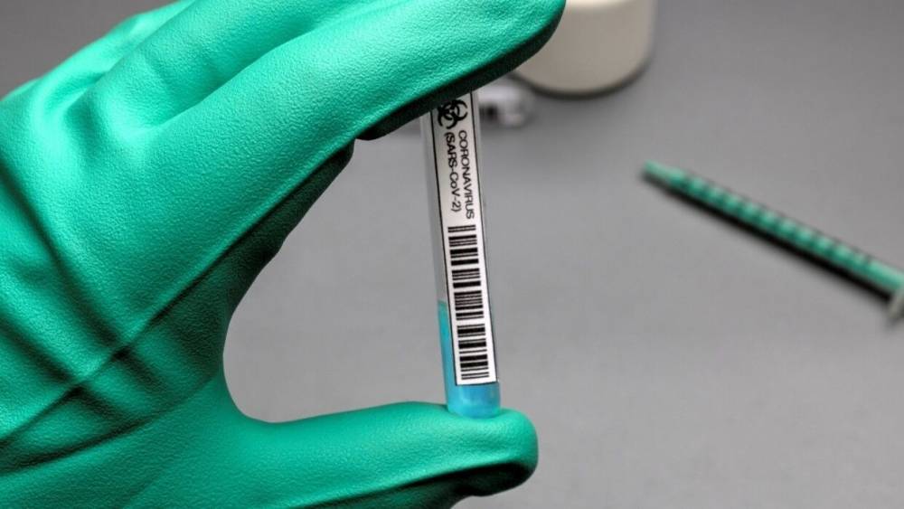 Российские медики сделали более 113 миллионов тестов на COVID-19 с начала пандемии